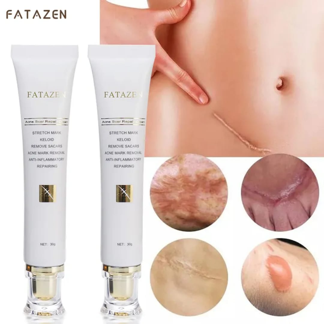Stretchmarks cream