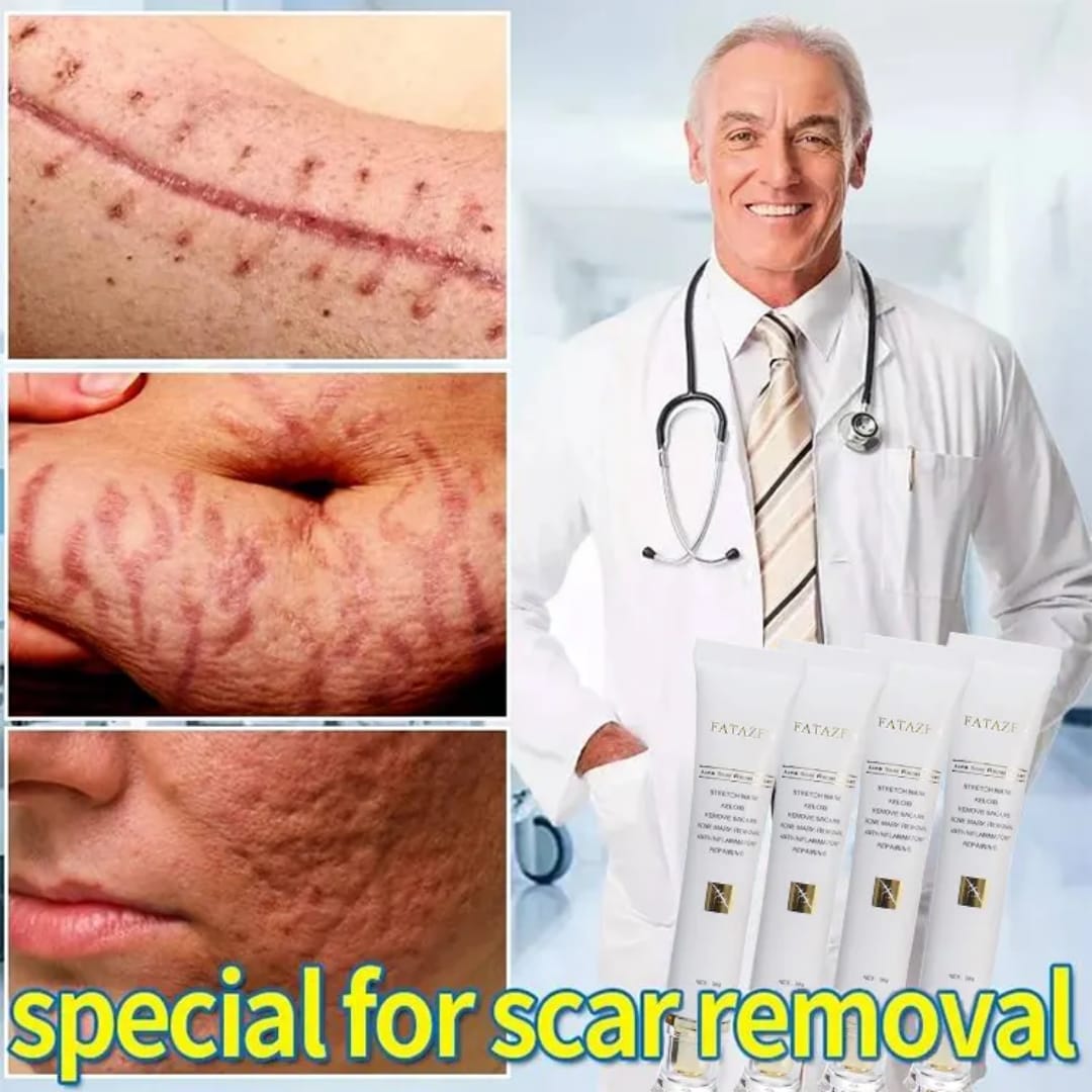 Stretchmarks cream