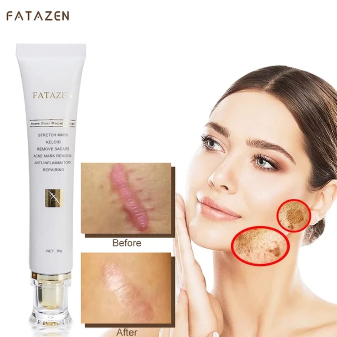Stretchmarks cream