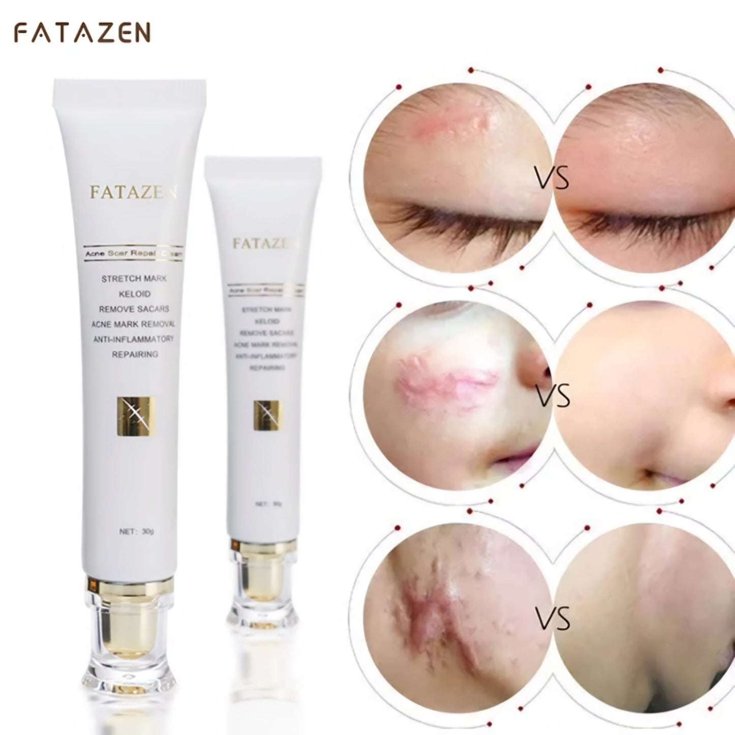 Stretchmarks cream