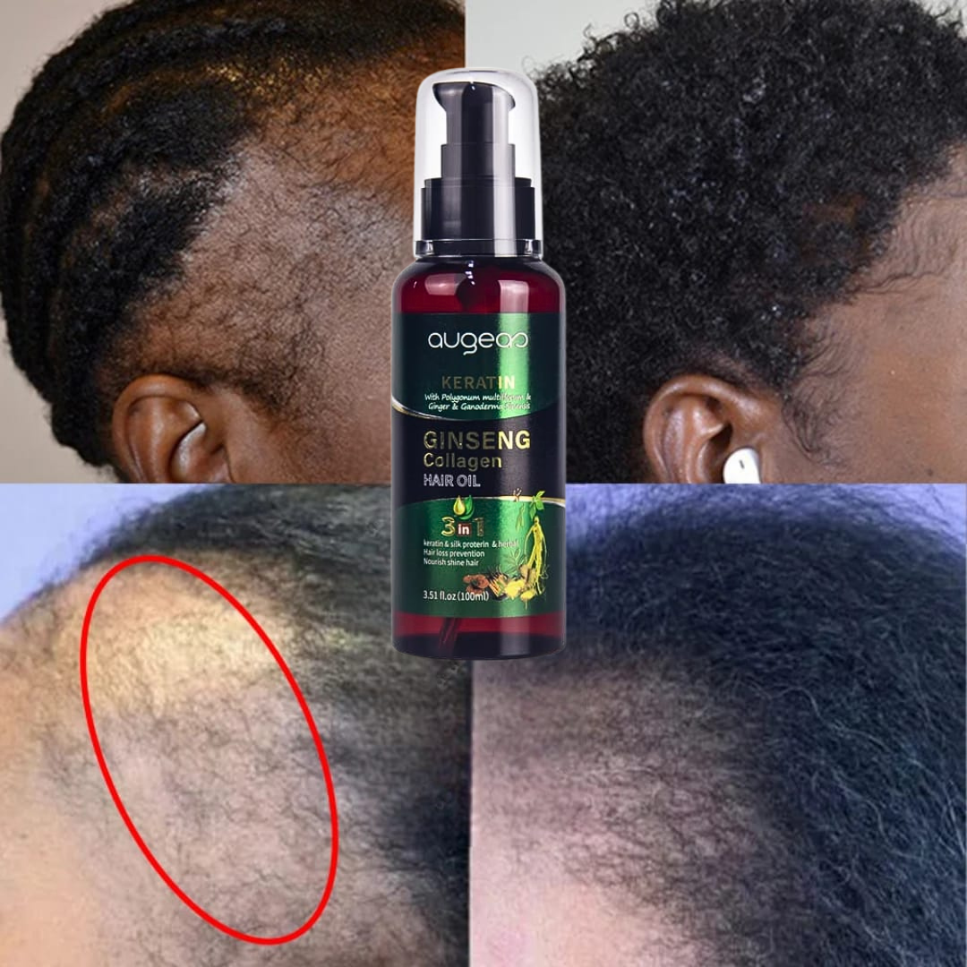 Hair growth oil