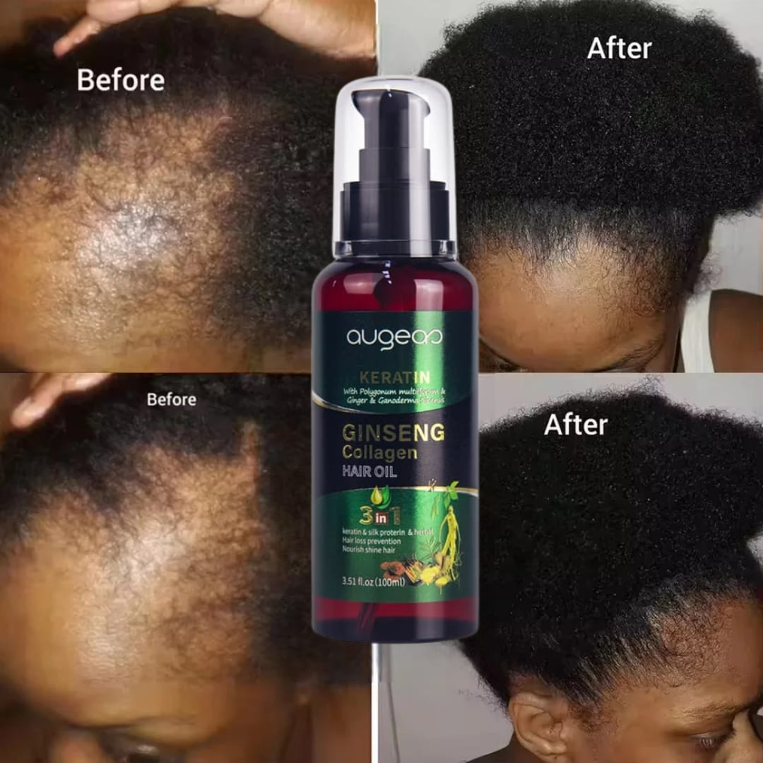 Hair growth oil