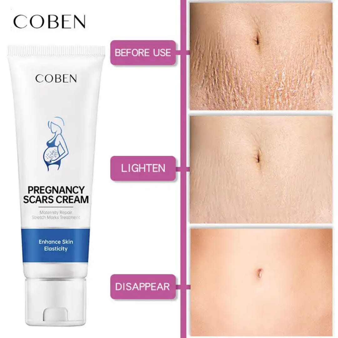 Pregancy scars cream