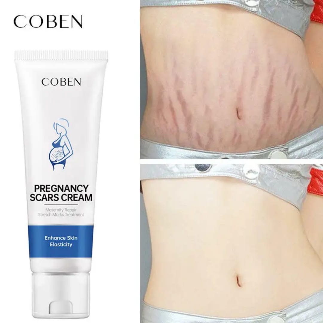 Pregancy scars cream