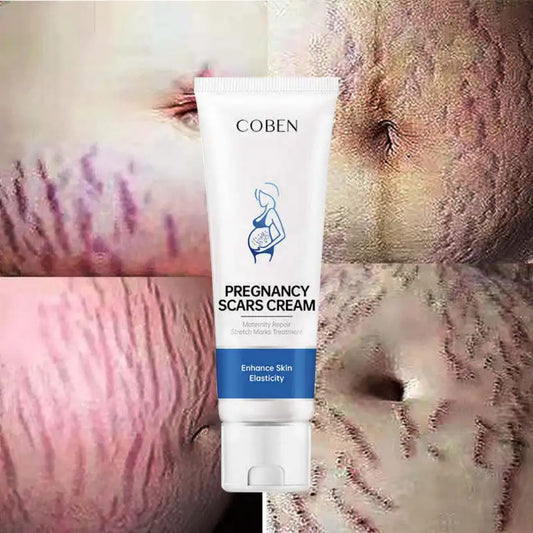 Pregancy scars cream