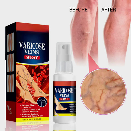 Varicose veins spray